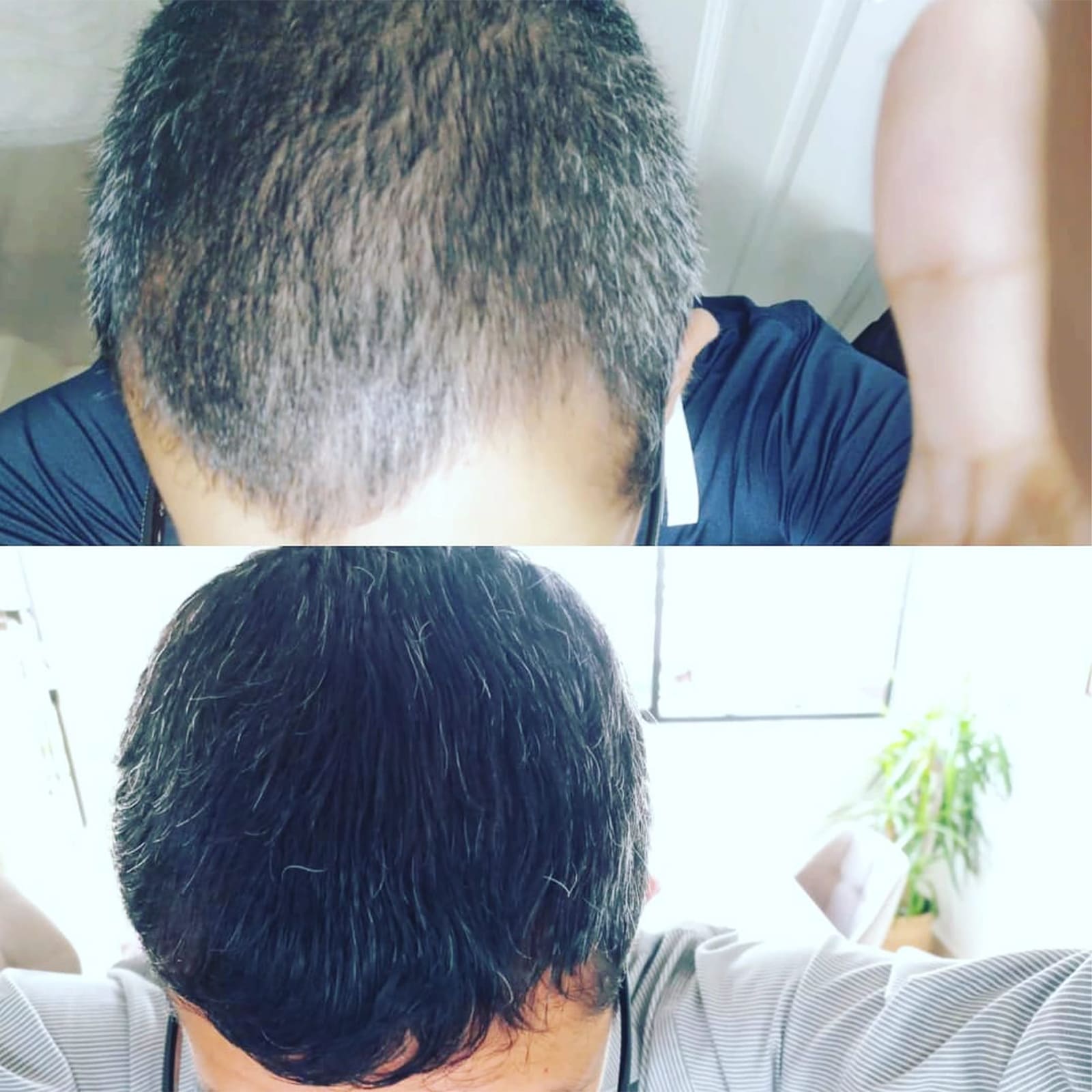 testimonio-de-tratamiendo-para-la-caida-del-cabello (3)