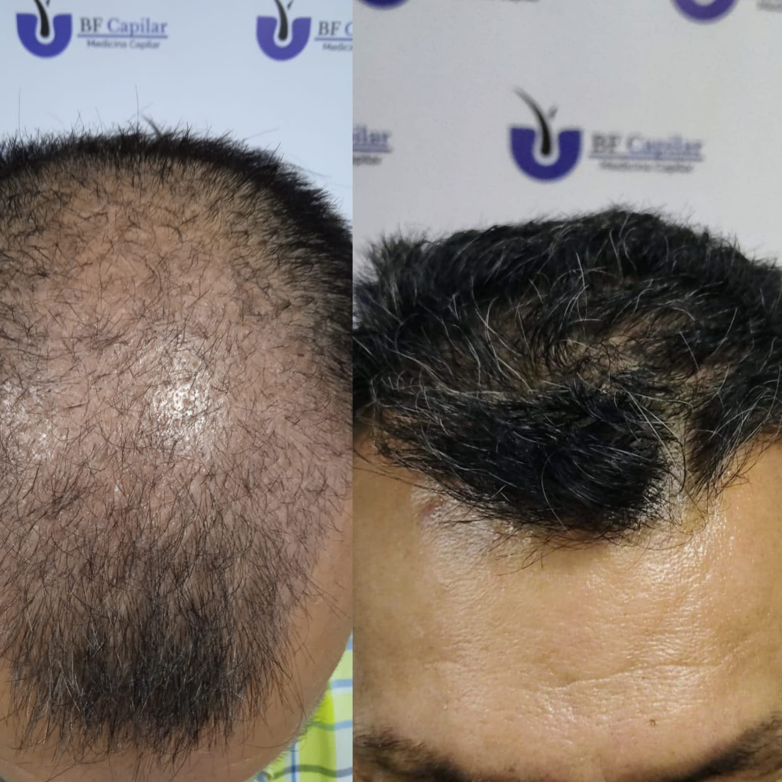 testimonio-de-tratamiendo-para-la-caida-del-cabello (6)
